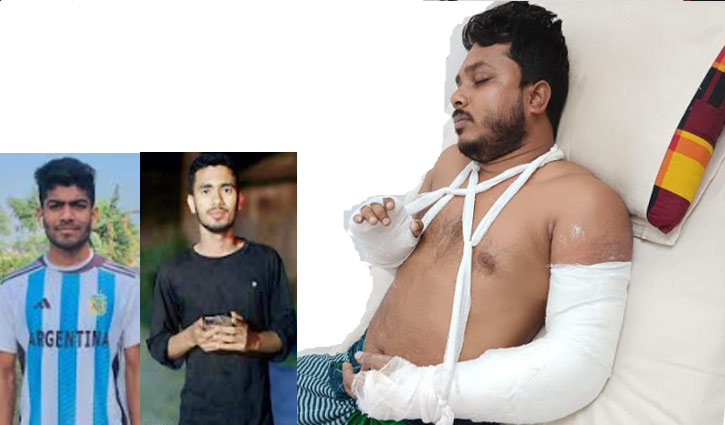 ছাত্রকে পিটিয়ে হাত ভেঙে দিলেন শিক্ষক